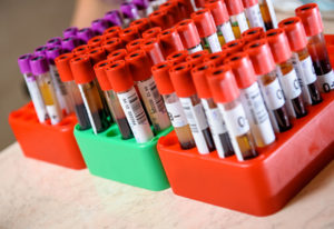 Does Mold Exposure Show Up on Blood Tests?