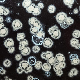 Mold Spores